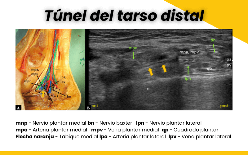 3. Tunel tarso proximal y distal ecografia tempo formacion.png